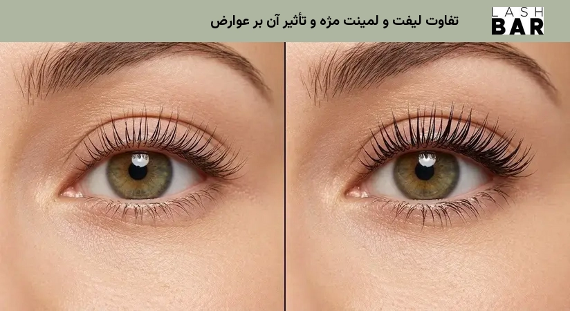 تفاوت لیفت و لمینت مژه و تأثیر آن بر عوارض