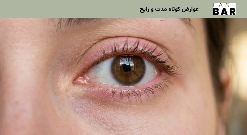 عوارض کوتاه مدت و رایج