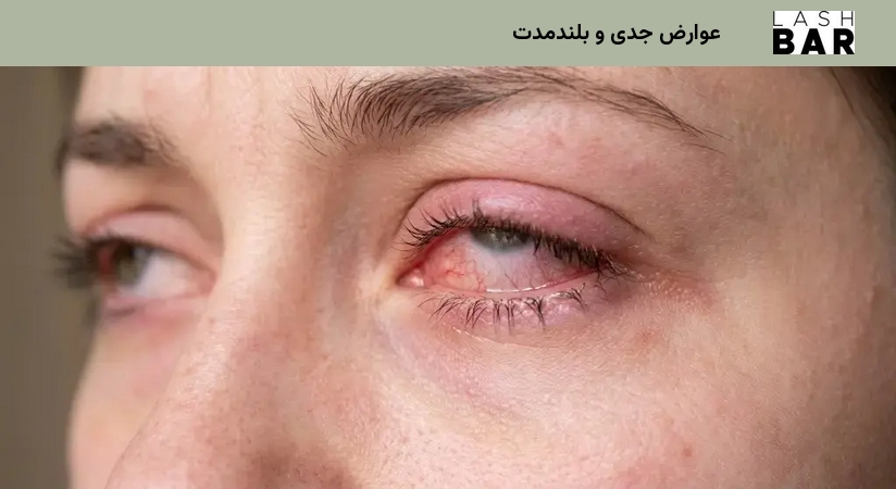 عوارض جدی و بلندمدت